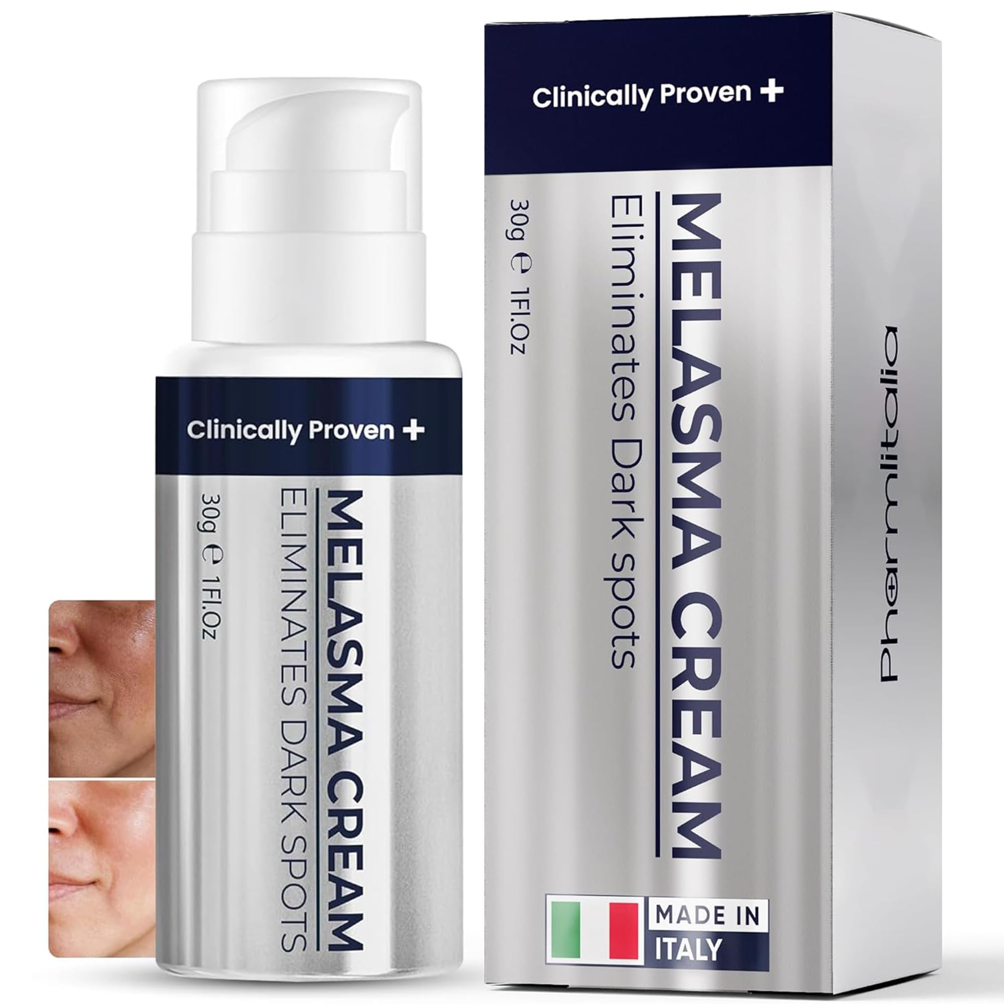 Face Melasma Treatment Cream & Age Spot Remover for Skin Discoloration, Post-Blemish Marks & Scars | Dark Spot Remover f